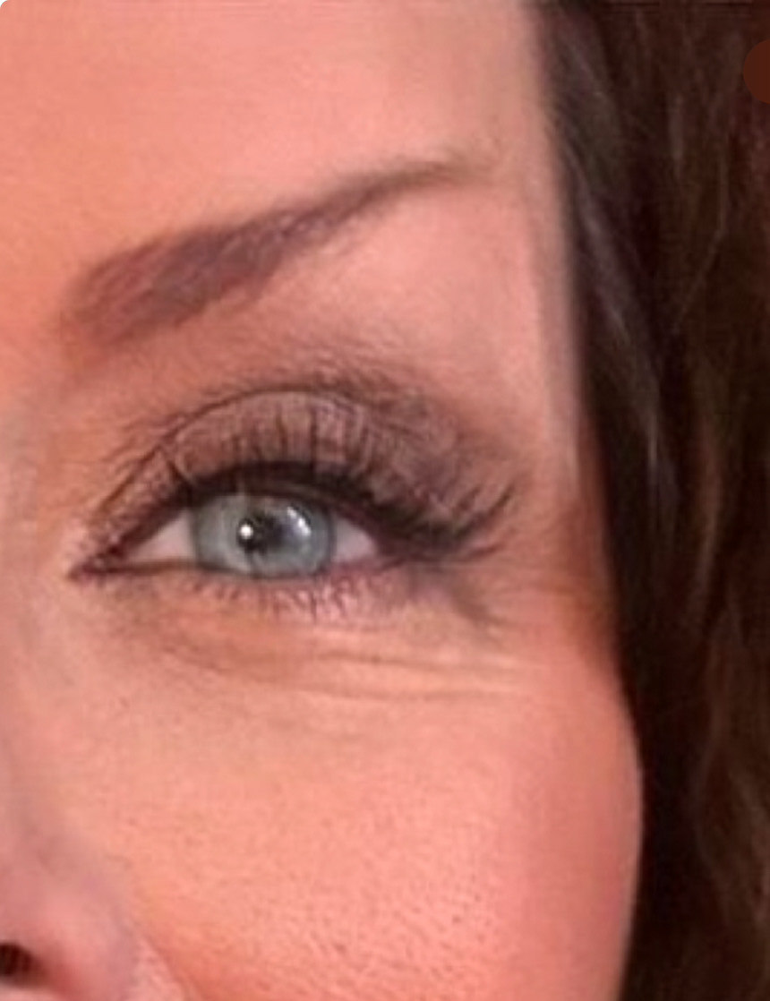 The Eye Serum review photo by Carolyn  F.