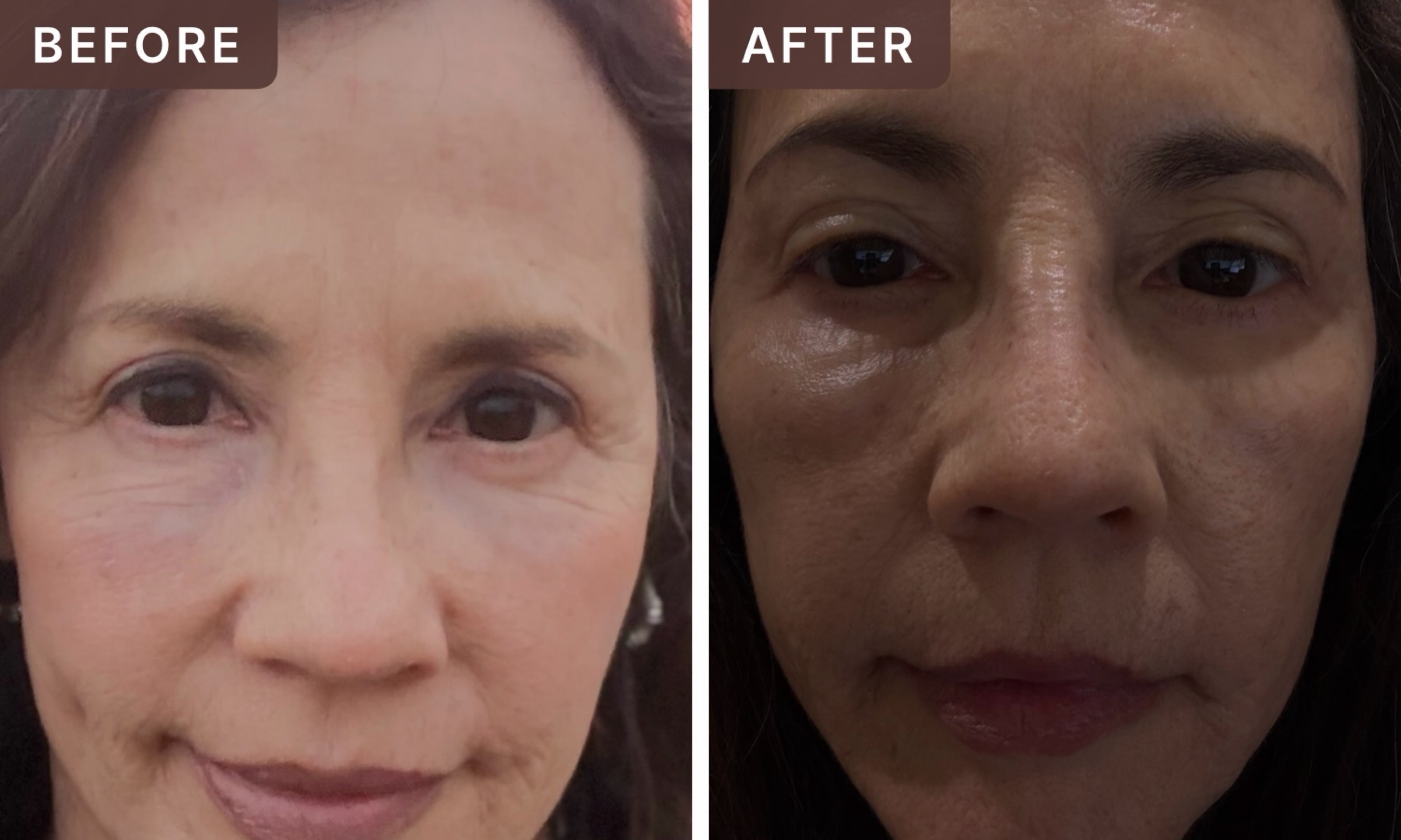 Yolanda M. -- before and after, 2 weeks