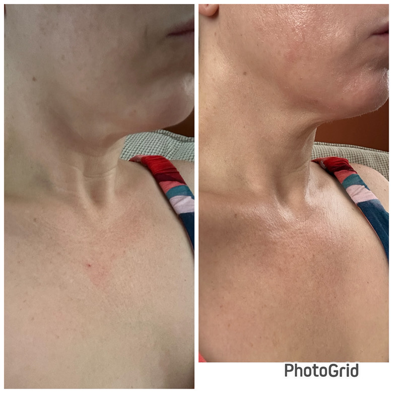 Customer photo