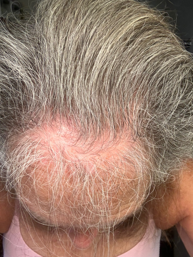 Post attachment 2