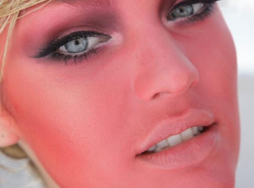 Musely Skin Regeneration Cream Side Effects & What To Do - Musely