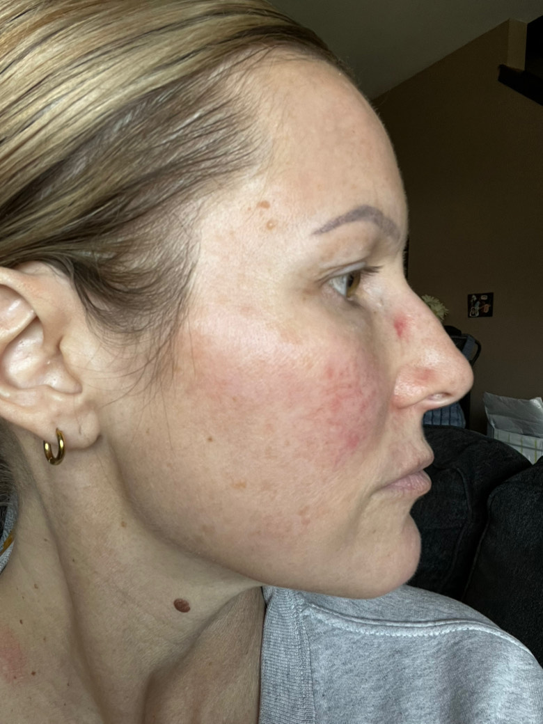 The Spot Cream review photo by Meaghan K.