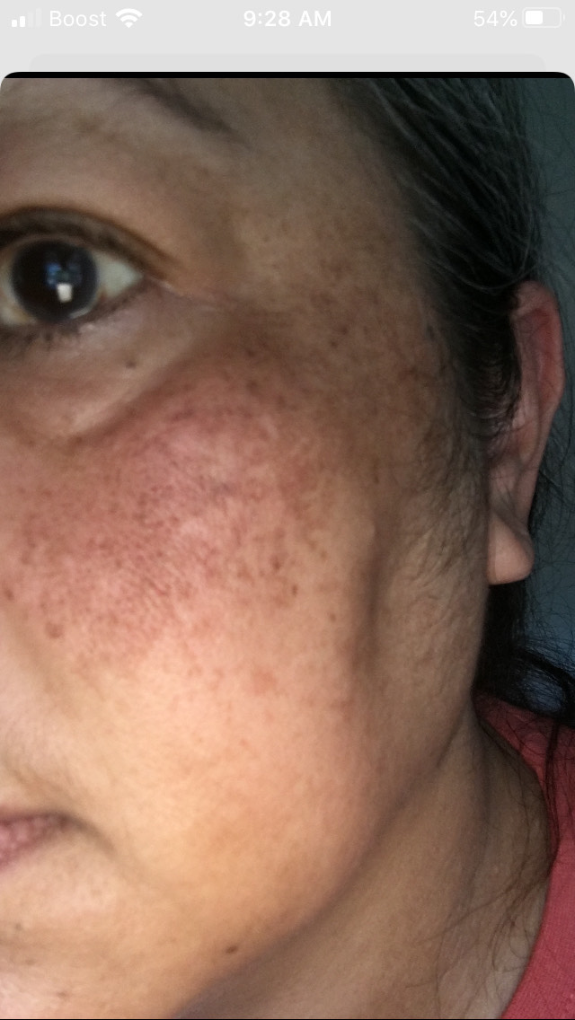 The Spot Cream review photo by Empresson E.