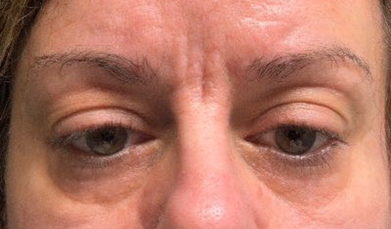 The Eye Serum review photo by Tami D.