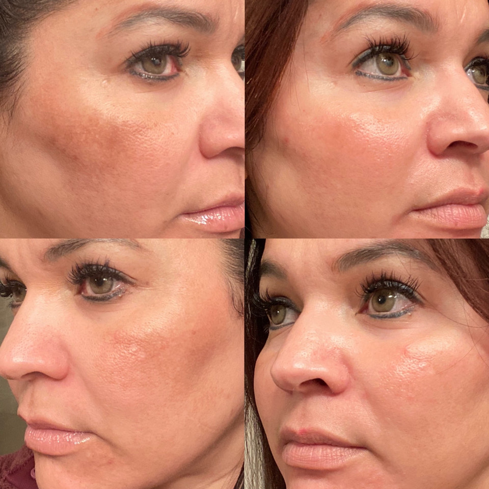The Spot Cream review photo by Alma B.