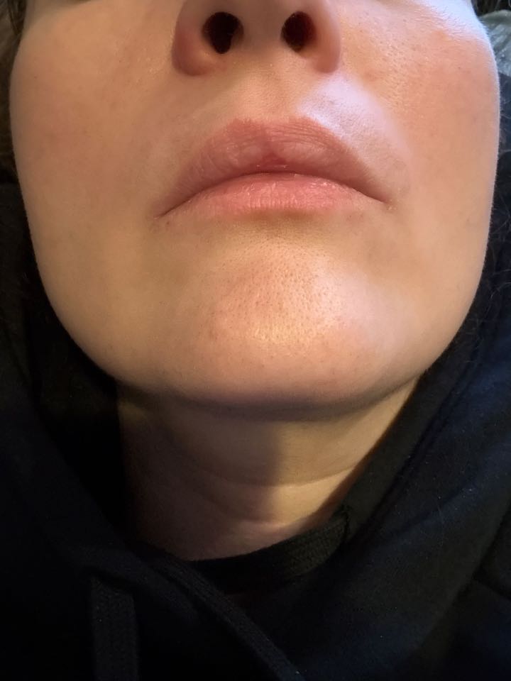 Customer photo