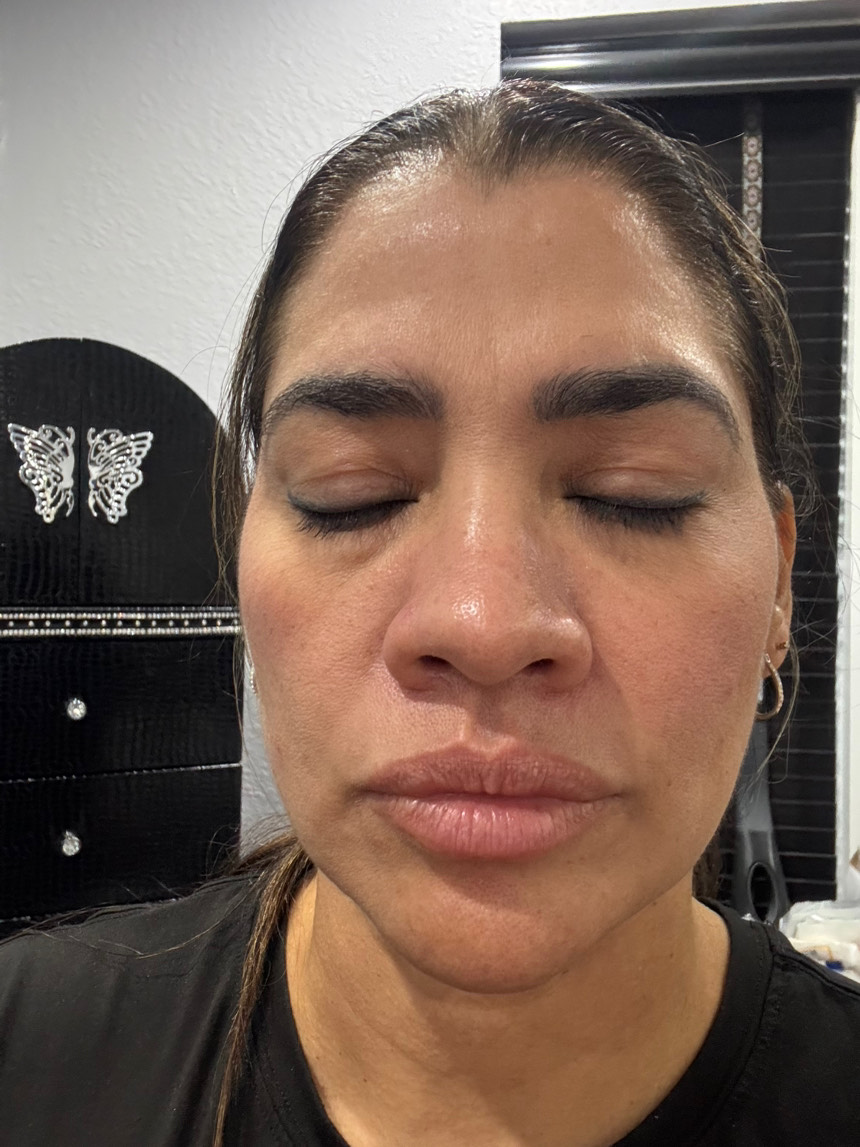 The Spot Peel review photo by Heidi V.