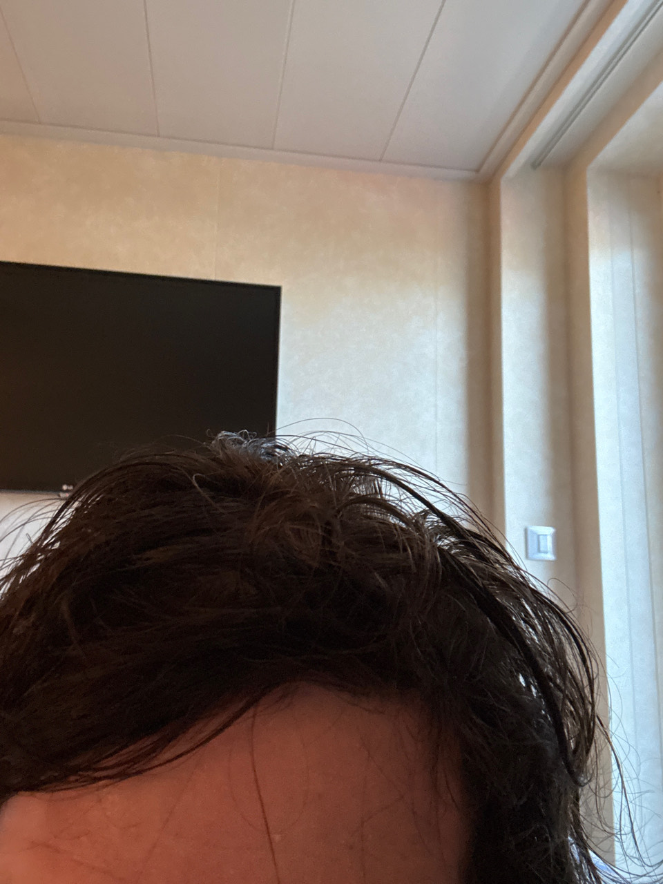 The Hair Topical Solution - Classic review photo by Michelle  C.