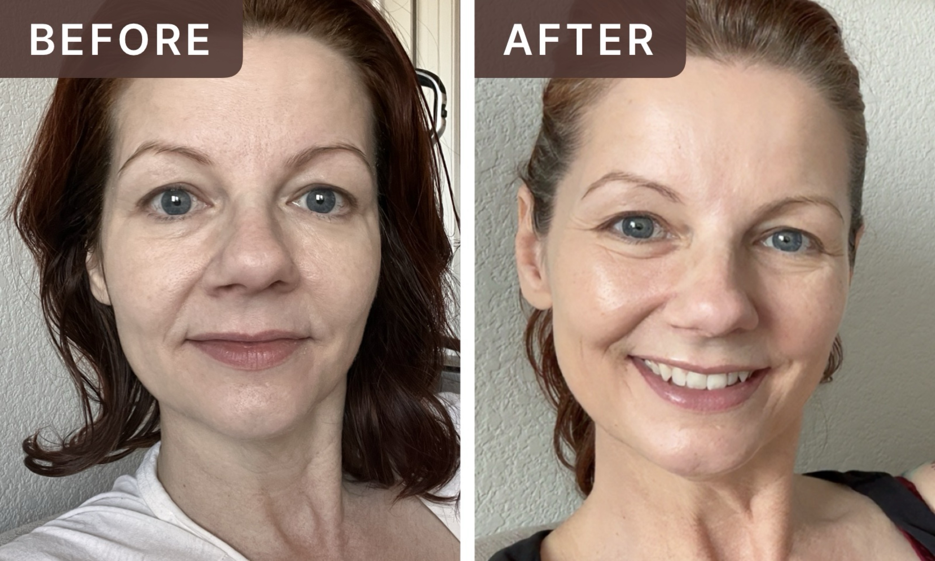 Rachael F. -- before and after, 8 weeks