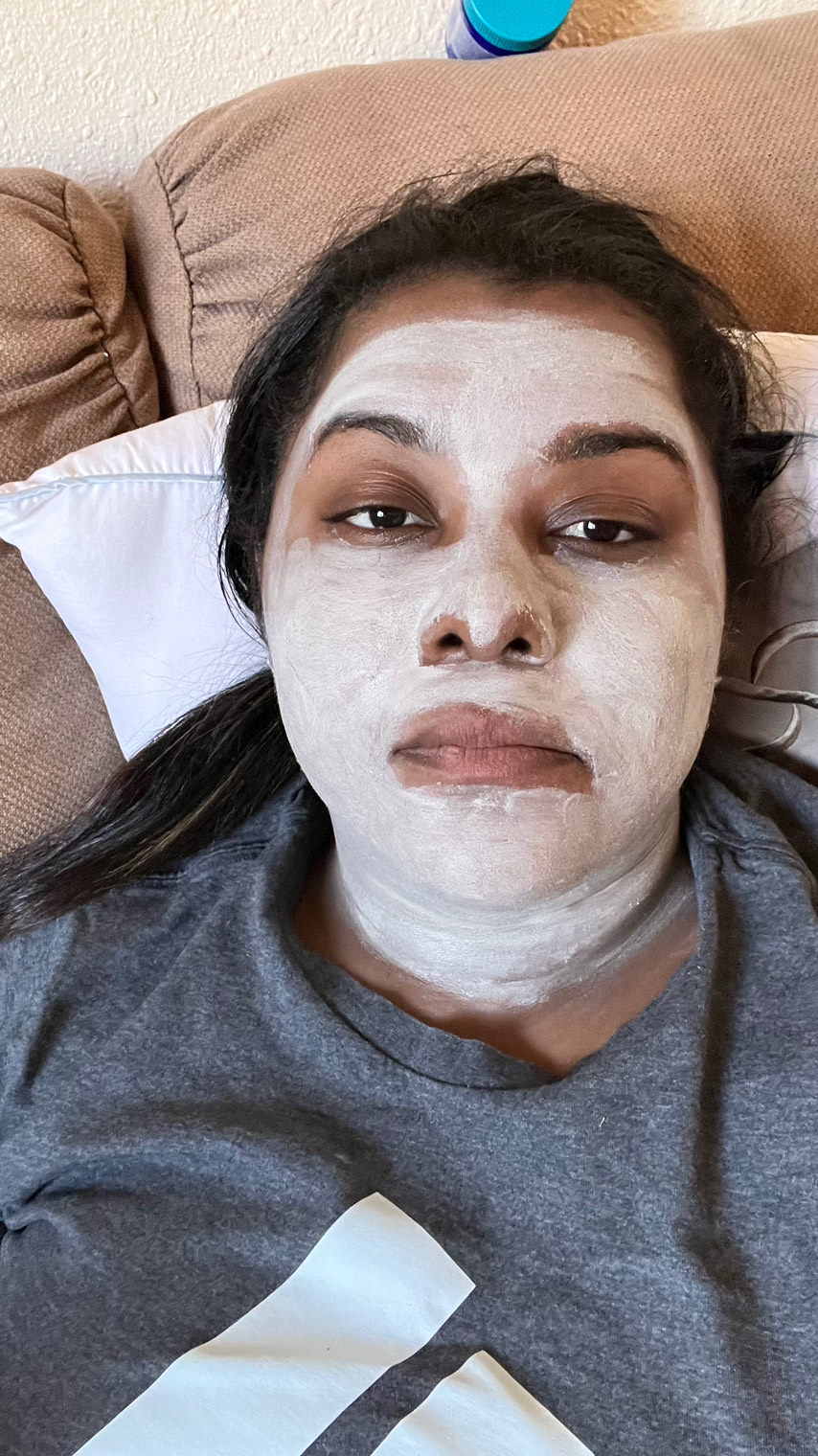 The Spot Peel review photo by Yauna F.