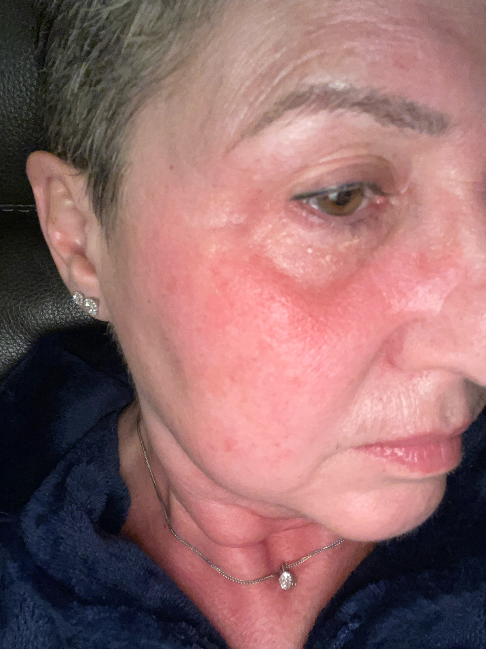 The Eye Serum review photo by Rochelle Primrose P.