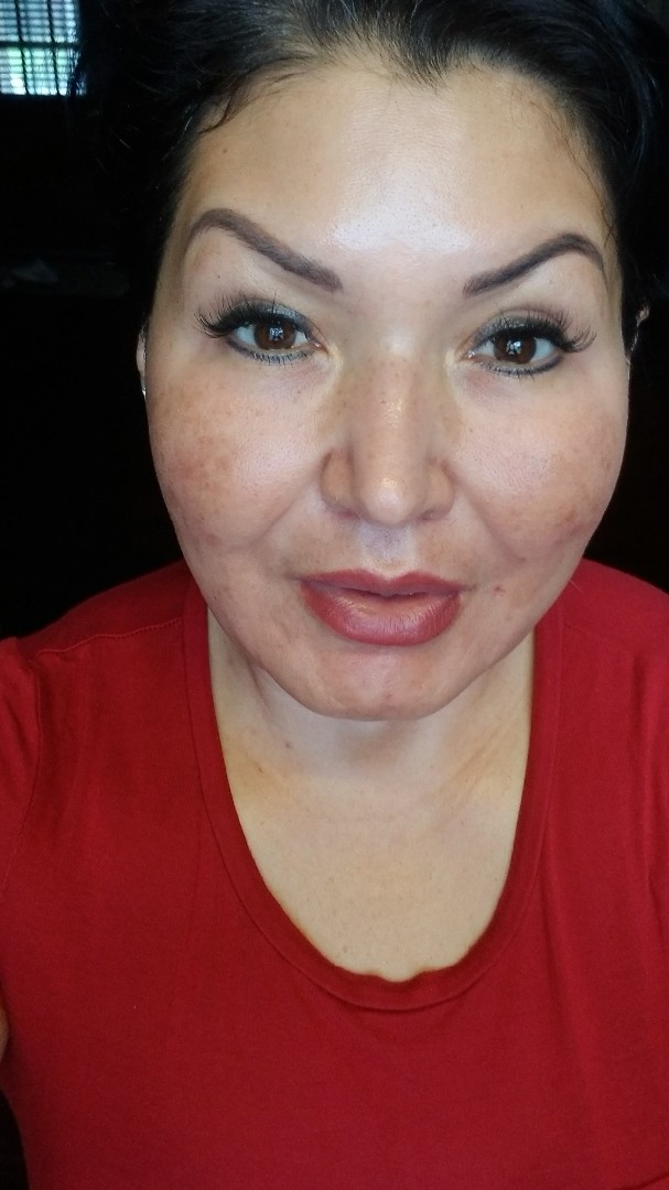 The Spot Cream review photo by Janeth Z.