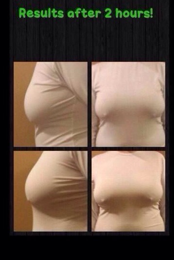 musely it works wraps breast lift