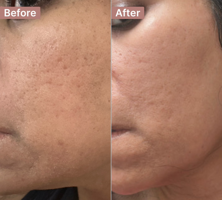 The Cell Repair Serum review photo by Sudipta B.
