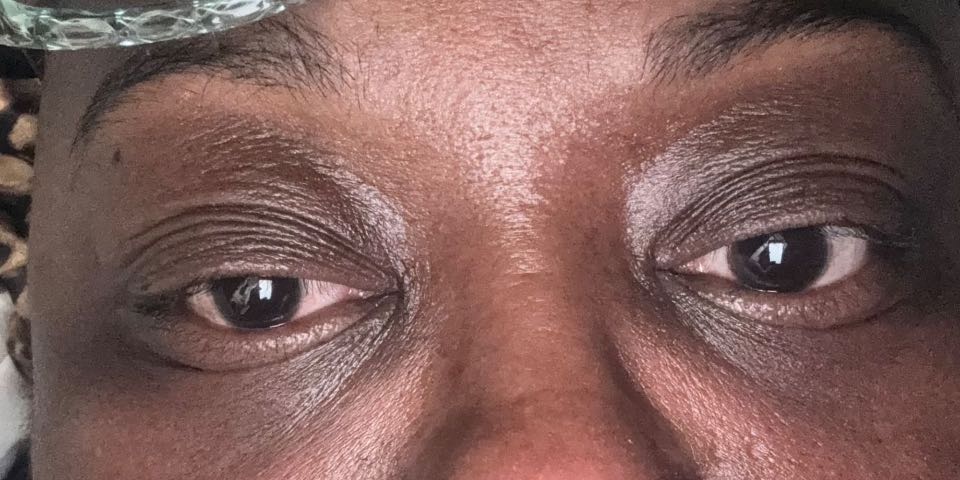 The Eye Serum review photo by Jowharah S.