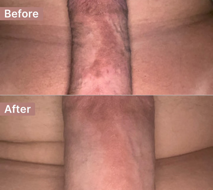 Post attachment 3