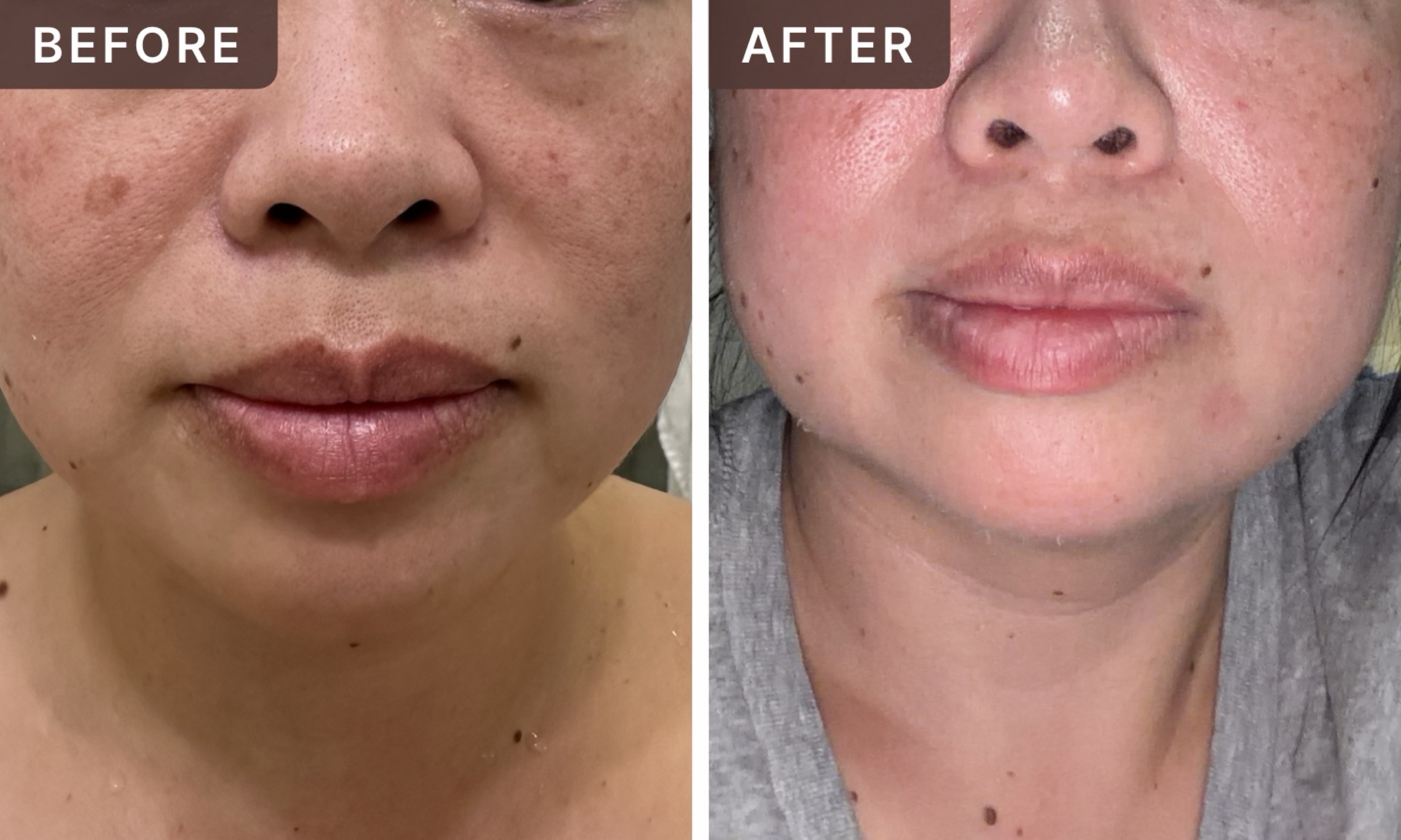 Jennifer H. -- before and after, 8 weeks