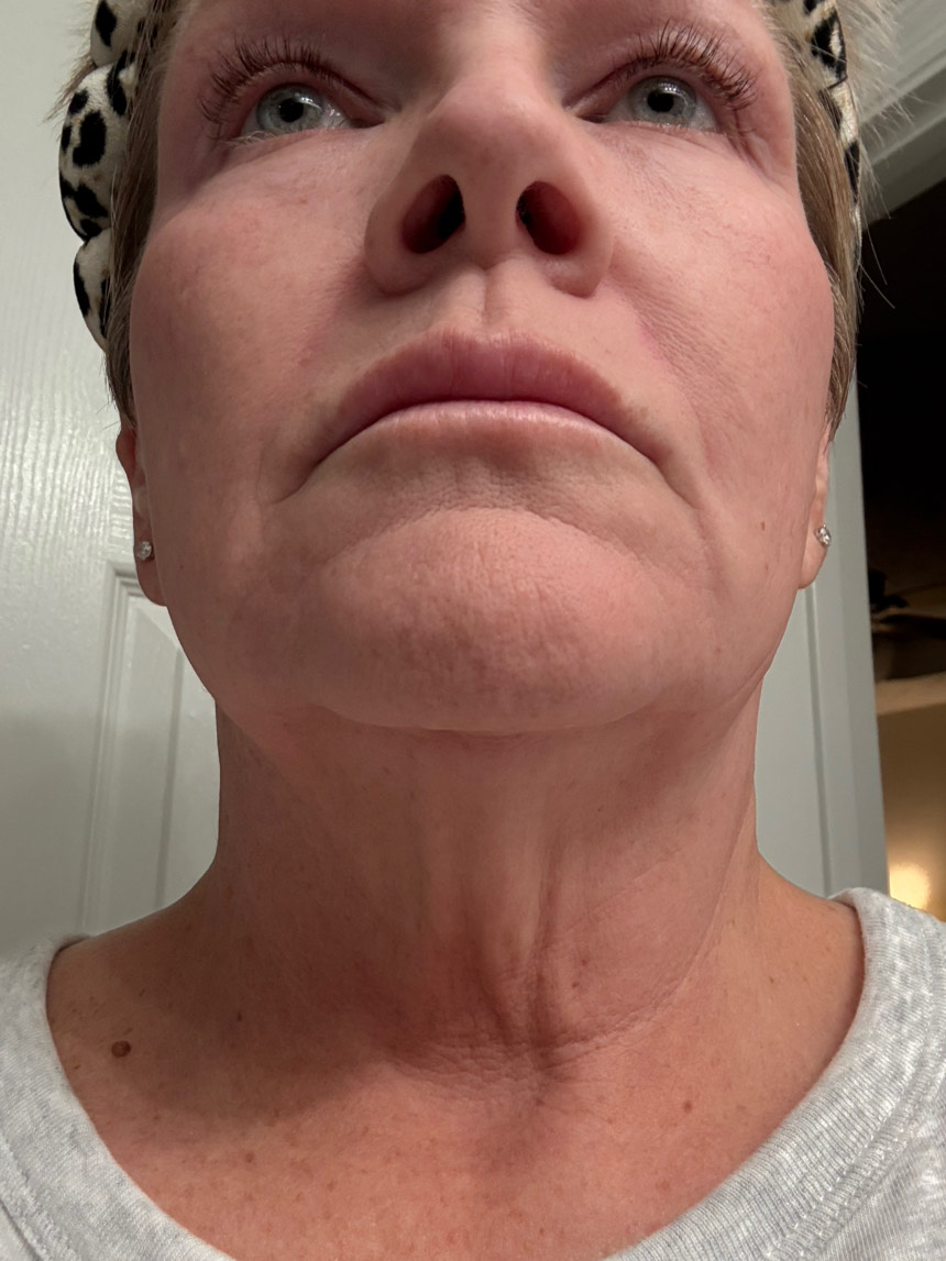 Customer photo