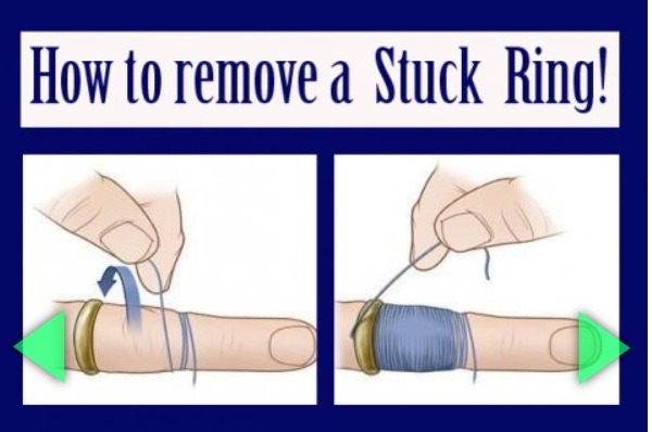String Trick To Remove Rings Best Way To Remove Ring _ How To Remove Ring Around The Collar – NEBD