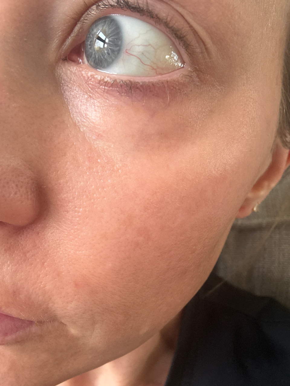 The Eye Serum review photo by Lauren V.