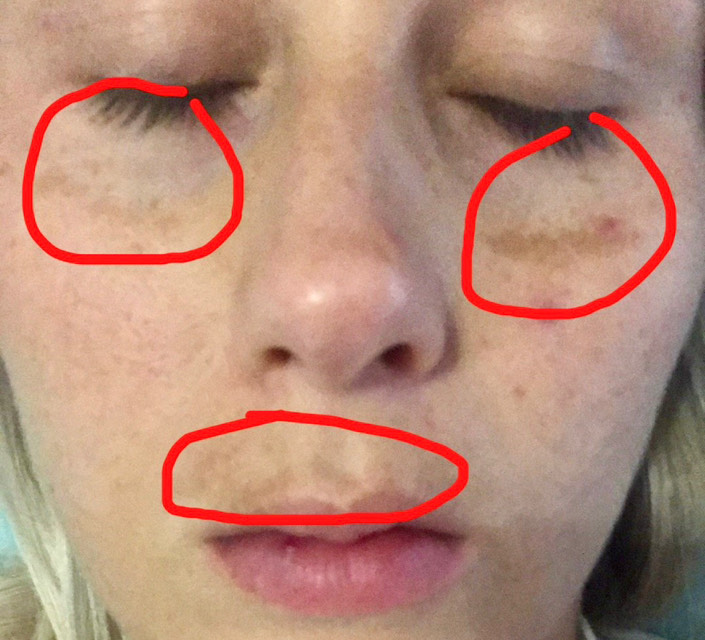 Post attachment 1