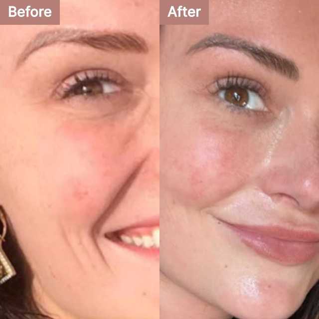 Kylie M. -- before and after, 8 weeks
