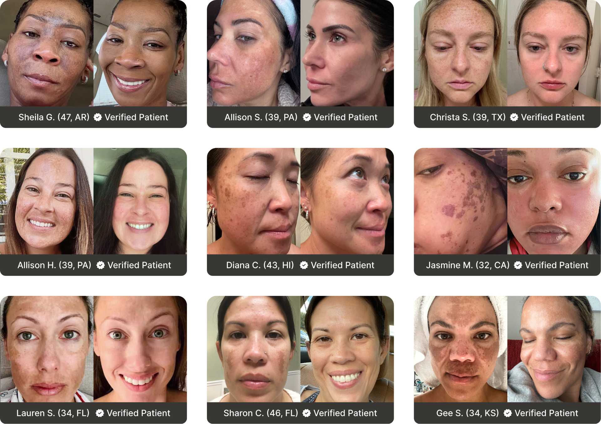 The Spot Cream Before and Afters