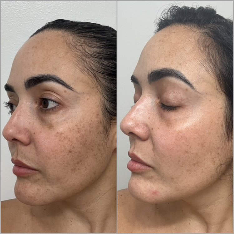 The Spot Cream review photo by Yannis J.