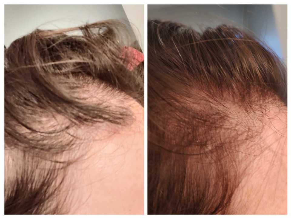Customer photo