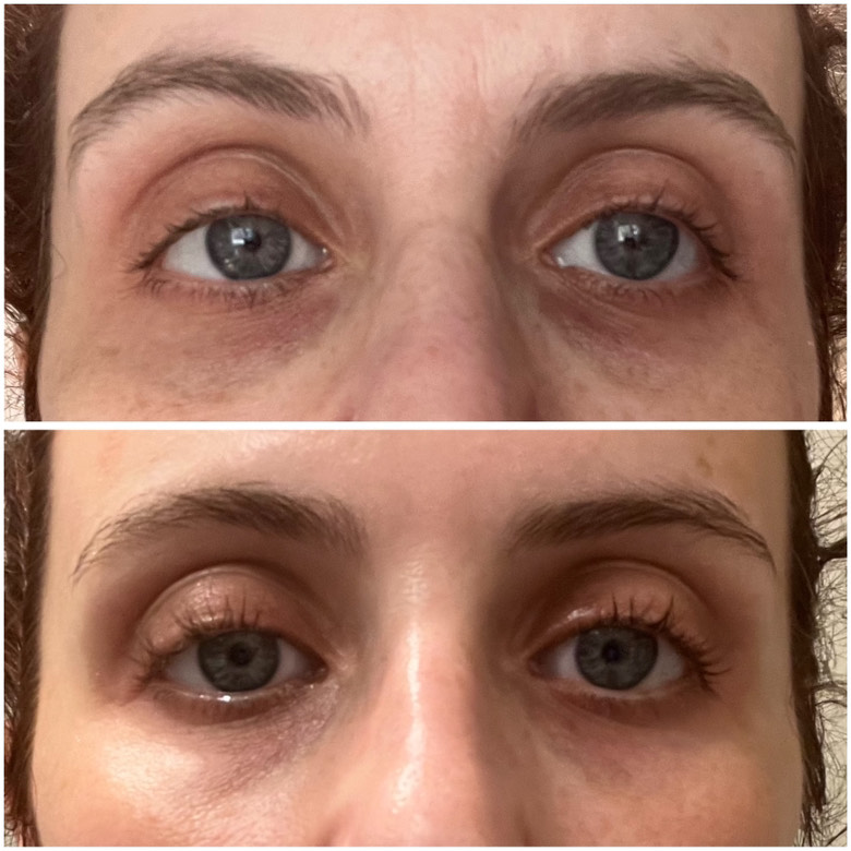 The Eye Serum review photo by Gina W.