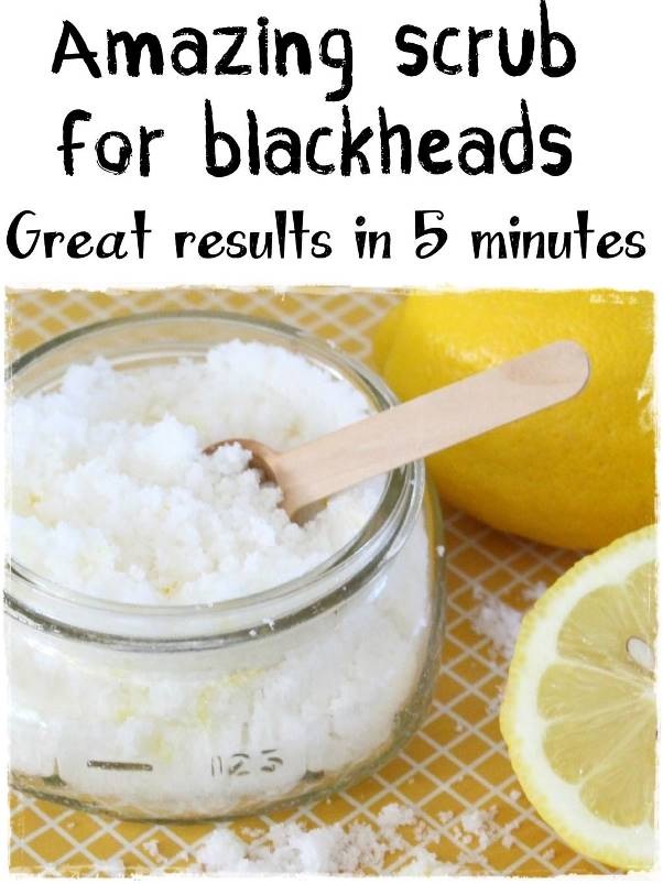 😇 5 Best Homemade Blackhead Remover Scrubs 😇 Musely