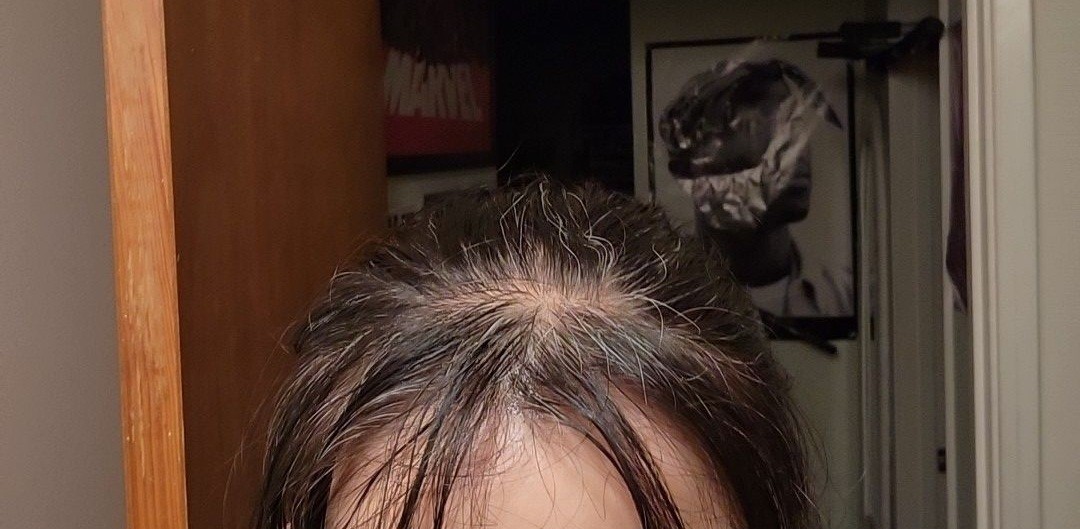 The Hair Topical Solution - Classic review photo by Lucina S.
