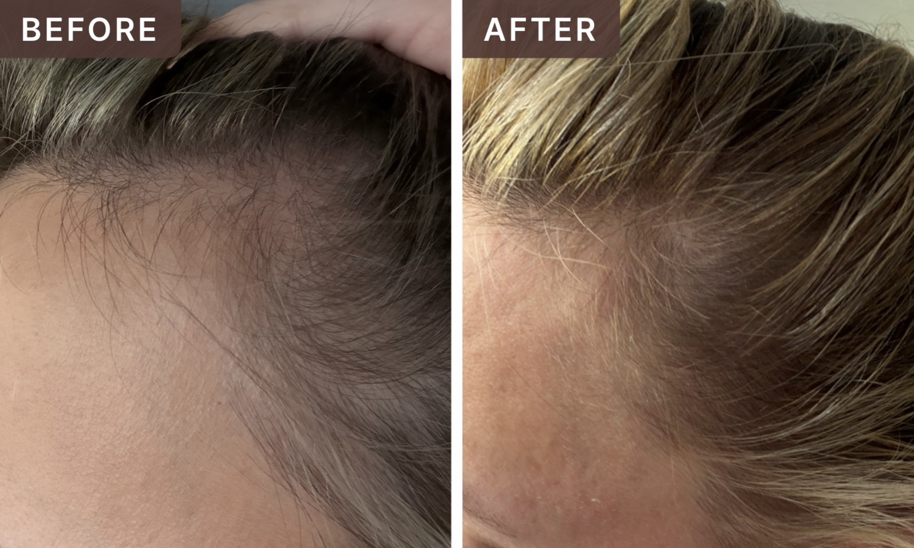 Amanda H. -- before and after, 8 weeks