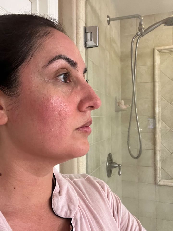 The Eye Serum review photo by Christine H.