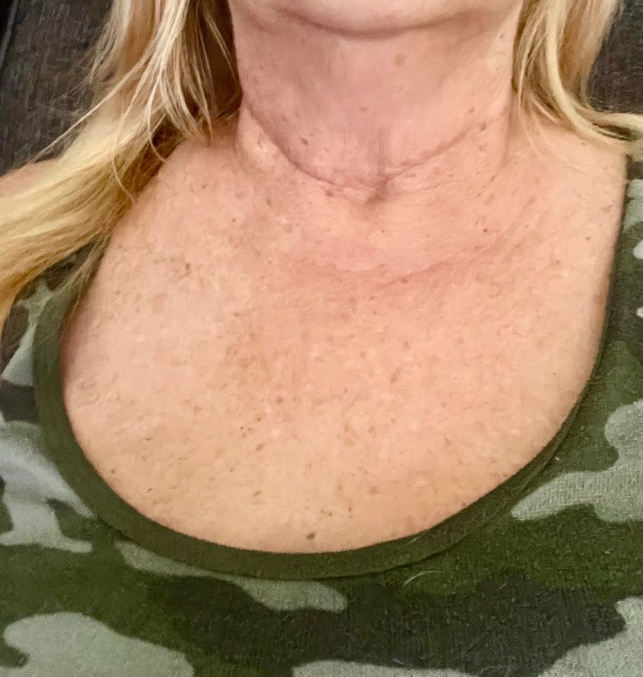 Customer photo