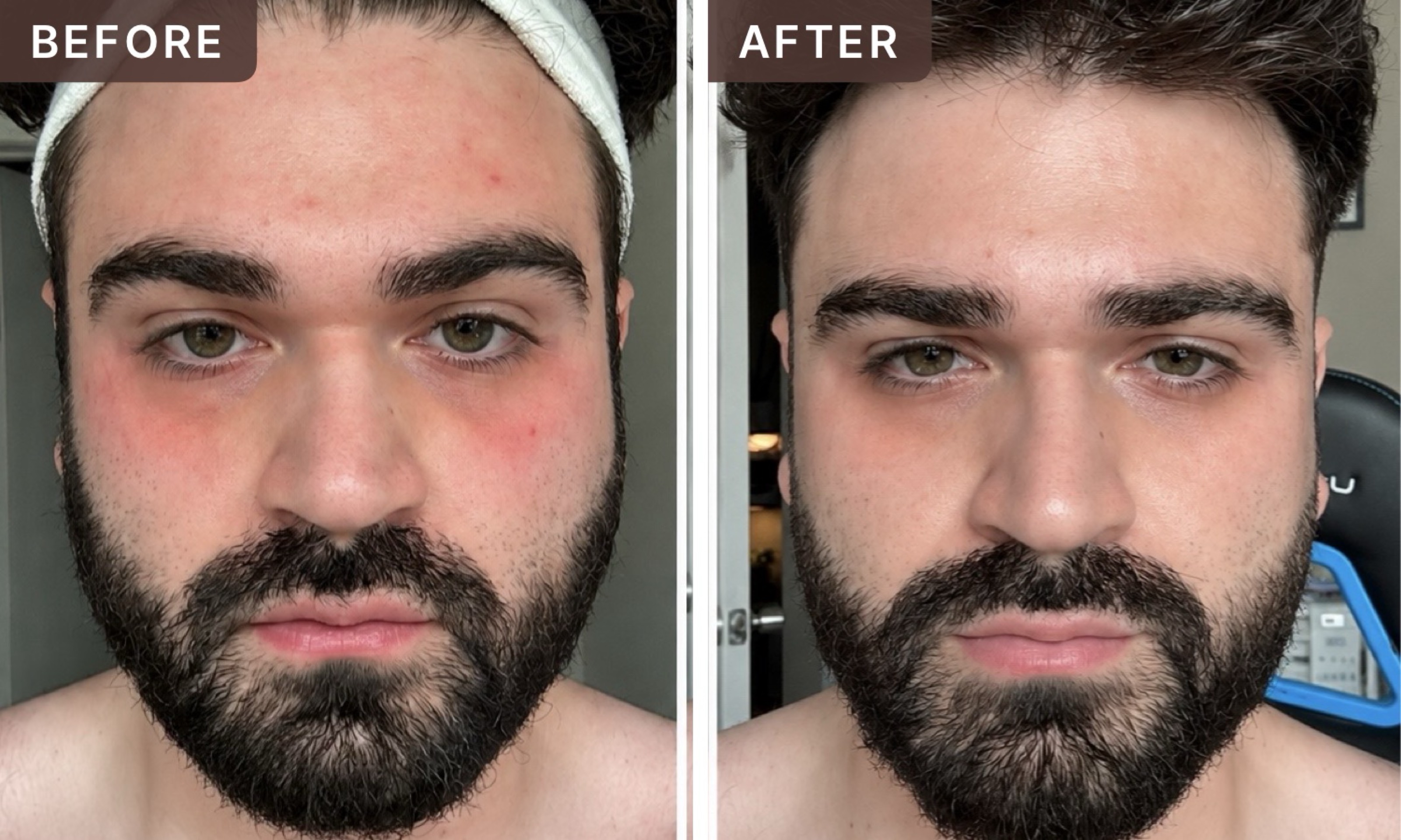Elijah C. -- before and after, 8 weeks