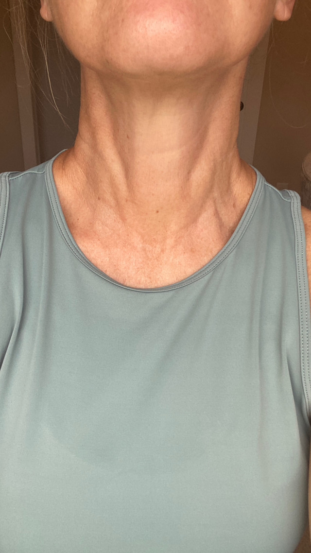 The Neck Cream review photo by Nicole I.