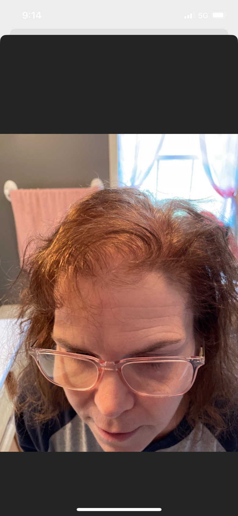 The Hair Pill review photo by Jennifer E.