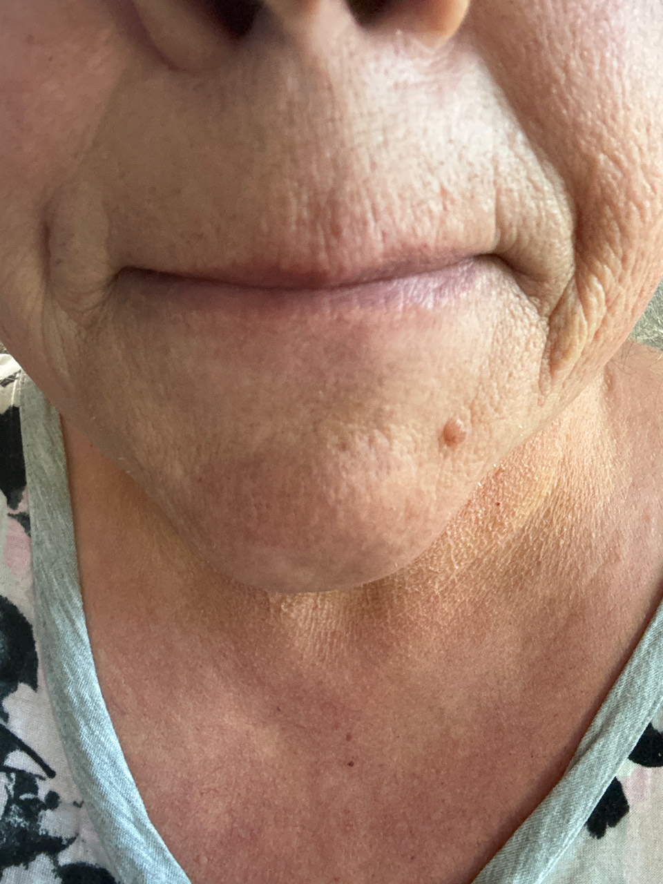 Customer photo