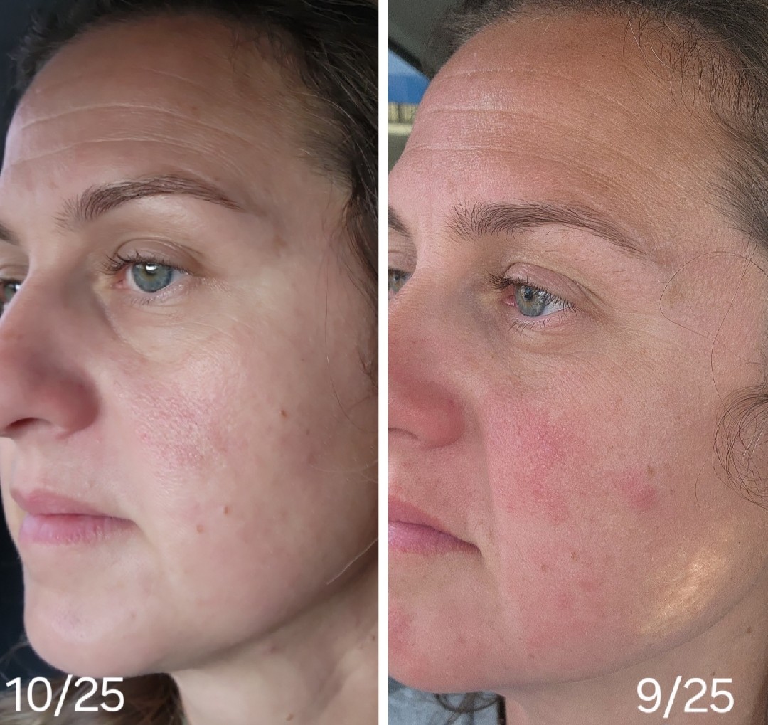 The Anti-Aging Cream review photo by Ashley L.