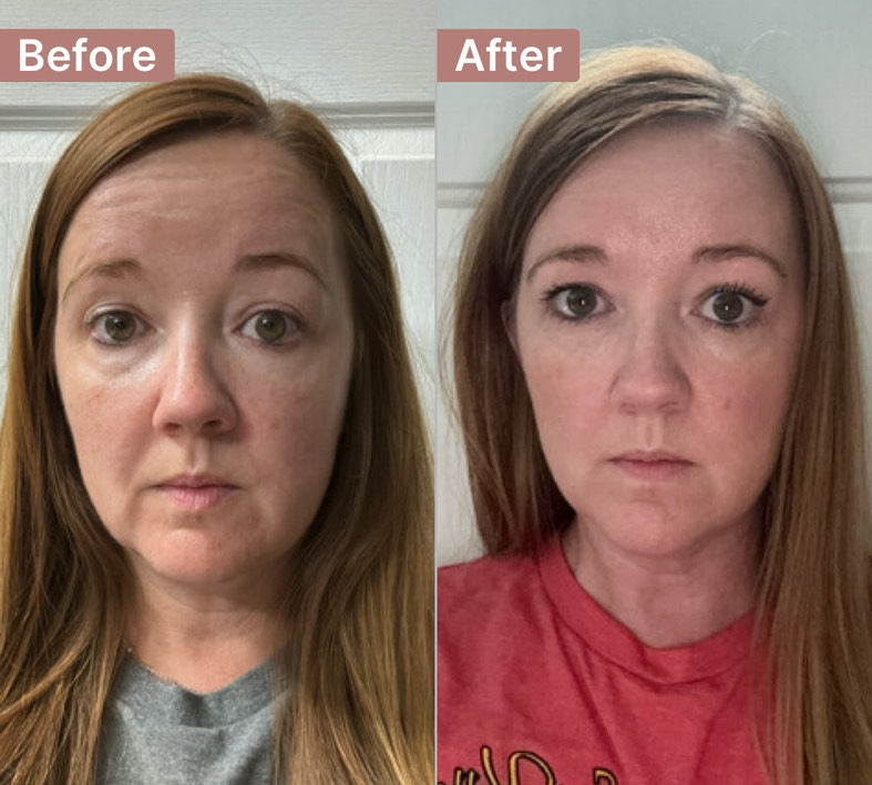Customer photo