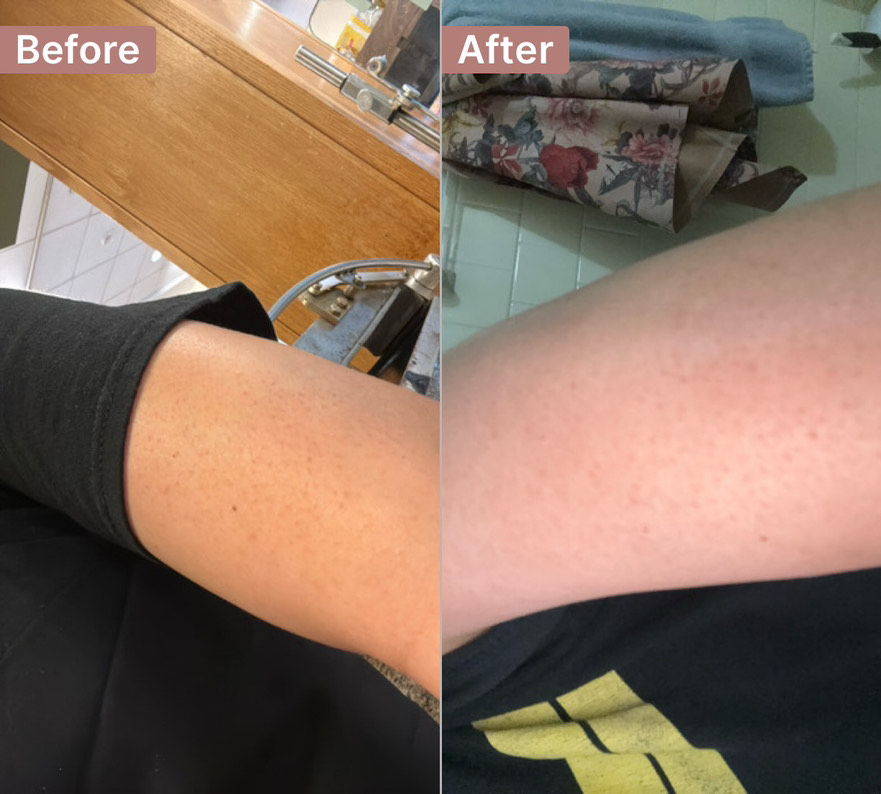 Customer photo