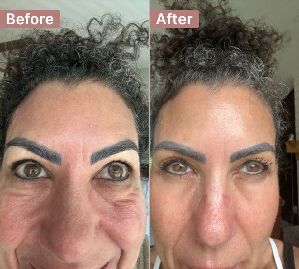 The Eye Serum review photo by Denise O.