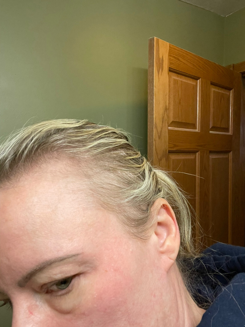 The Hair Pill review photo by Amber H.