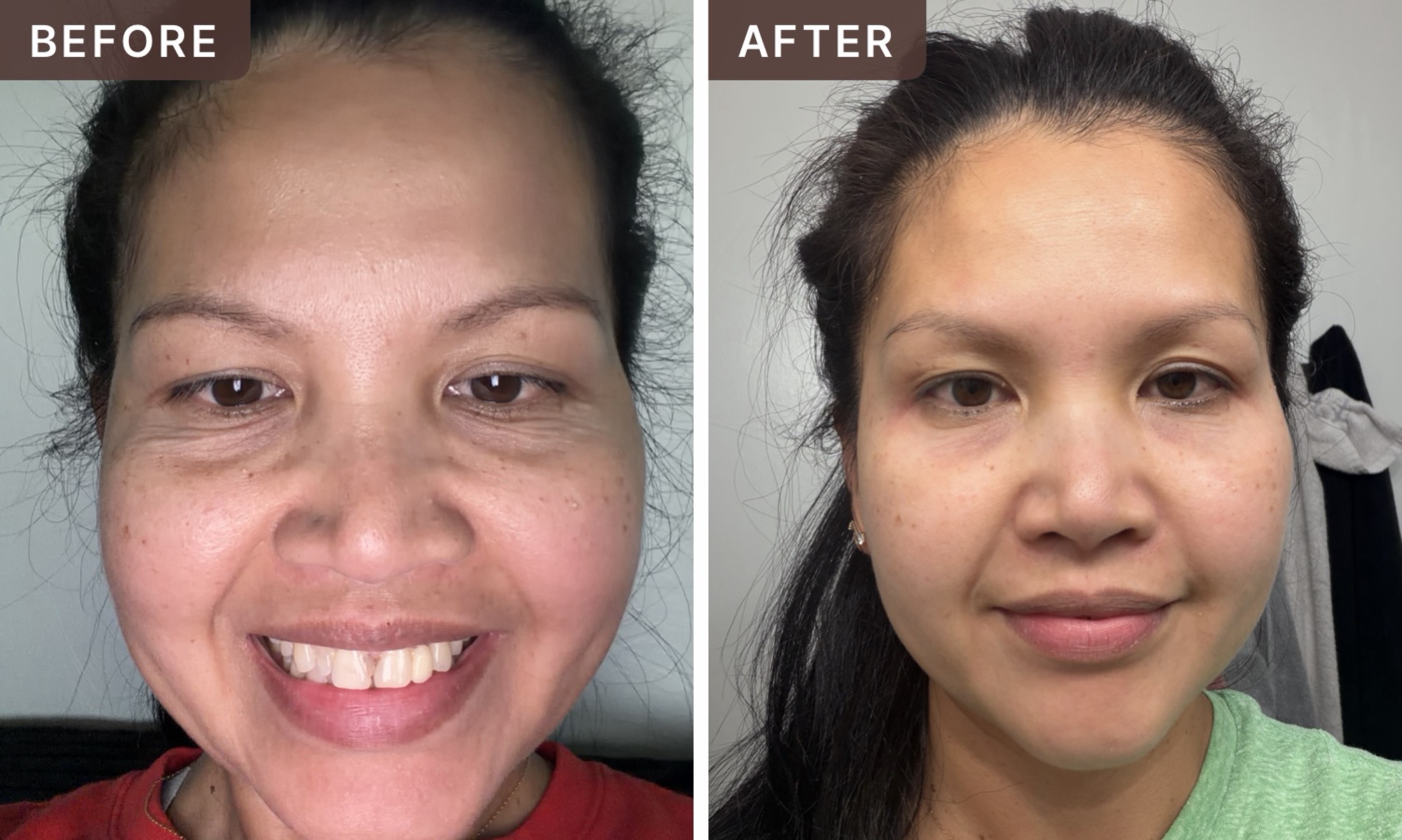 Donna M. -- before and after, 8 weeks