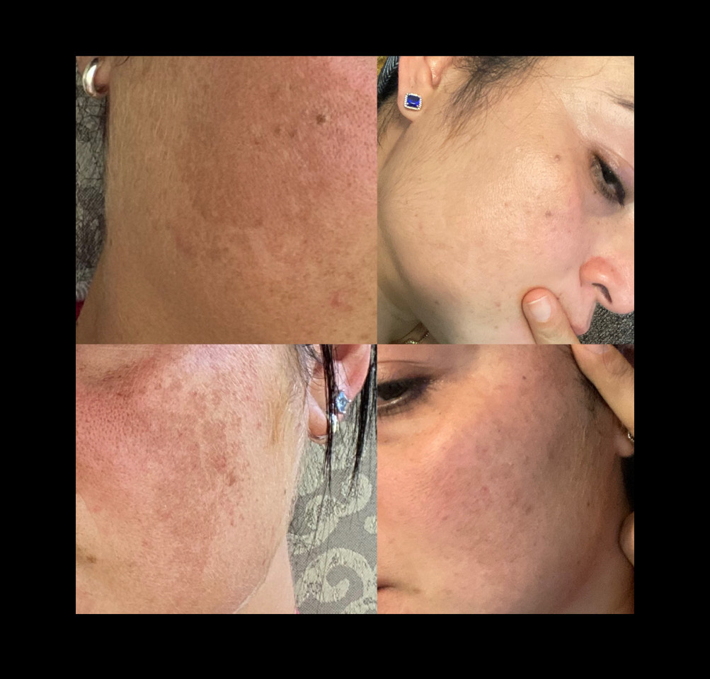The Spot Cream review photo by Glenda C.