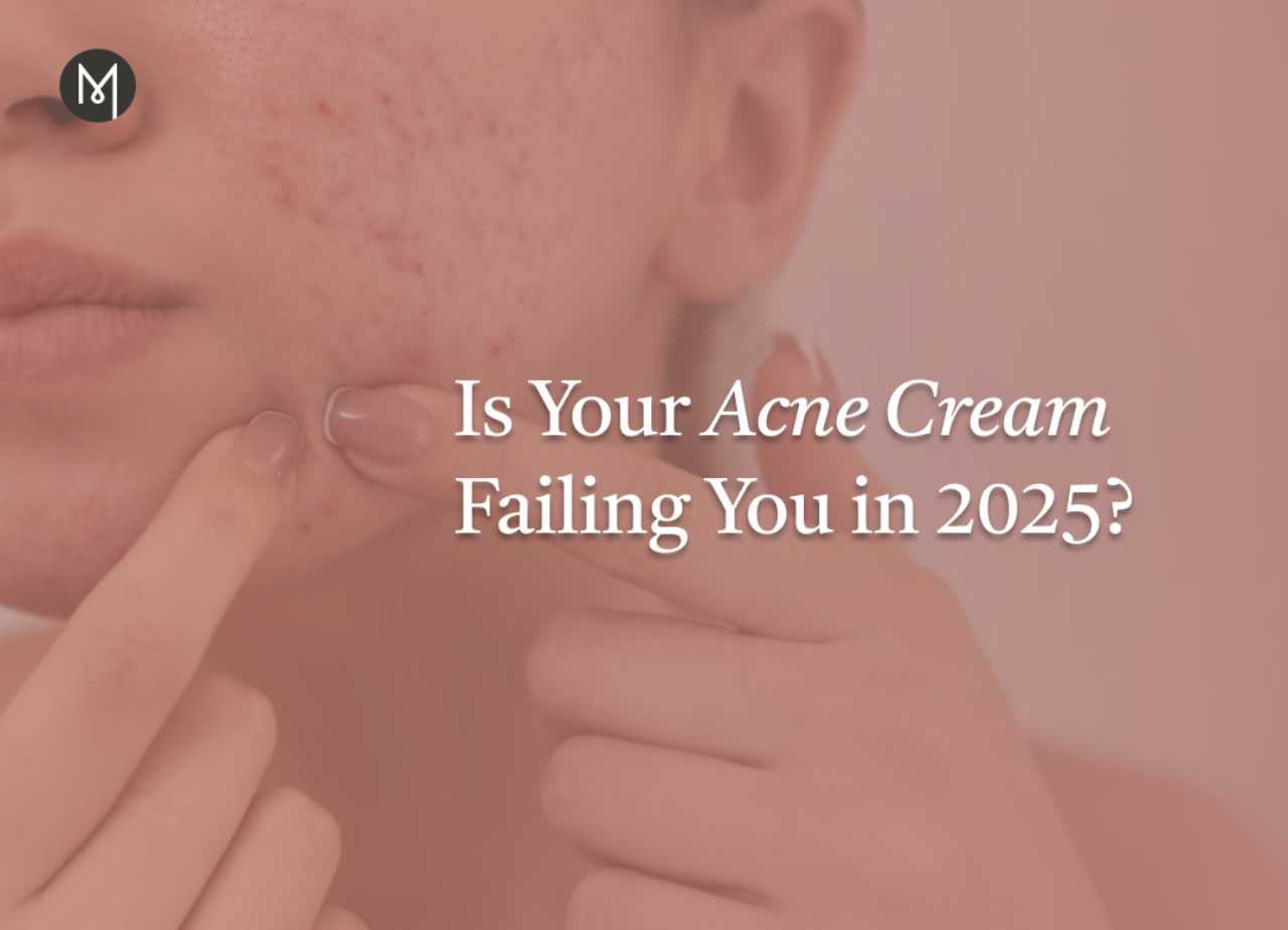 Is Your Acne Cream Failing You in 2025?