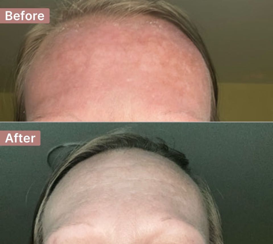 The Spot Cream review photo by 🐞Bridget🐝 N.