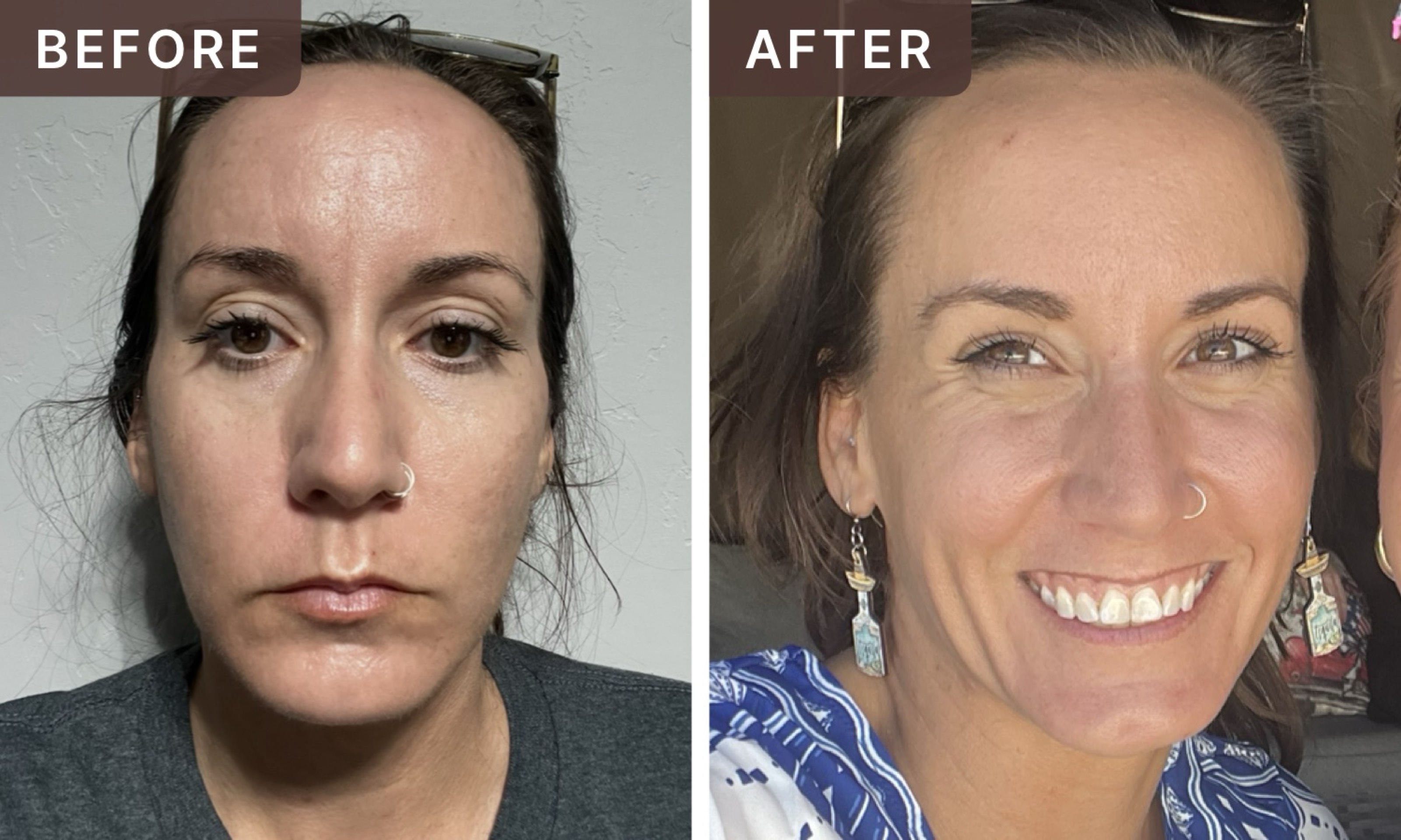 Amanda Y. -- before and after, 8 weeks