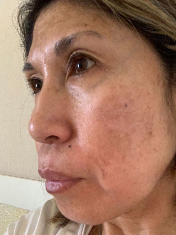 The Spot Cream review photo by Dolores A.